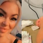 Bodrum Tatili Sonrası Kuduz Teşhisi Koyulan İngiliz Turistin Şaşırtıcı Hikayesi