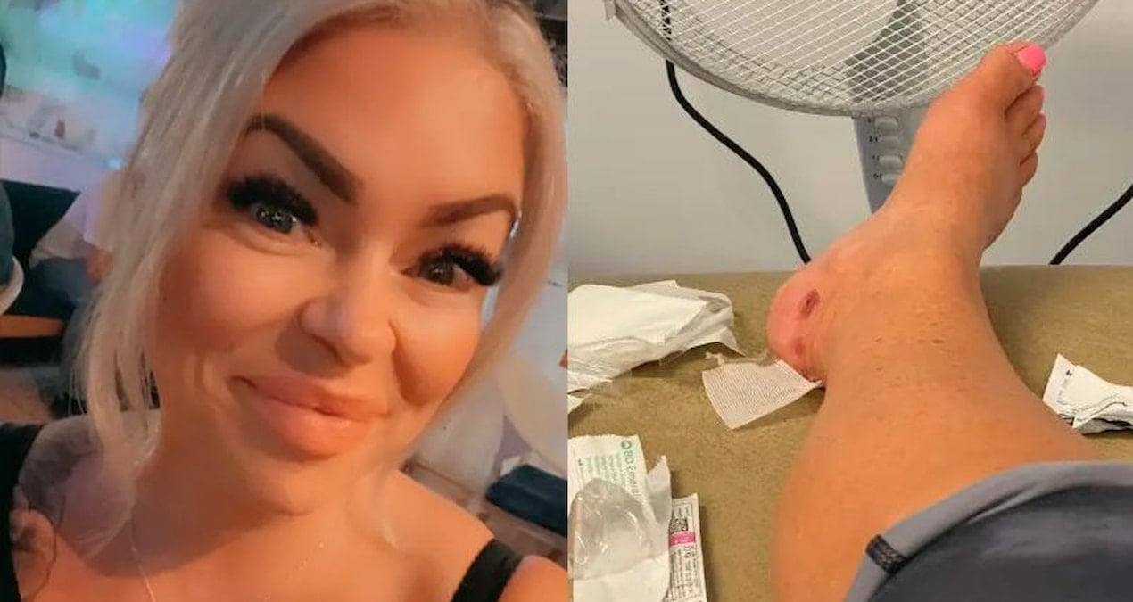 Bodrum Tatili Sonrası Kuduz Teşhisi Koyulan İngiliz Turistin Şaşırtıcı Hikayesi