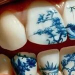 Diş dövmeleri estetik trend olarak hızla yaygınlaşıyor, ancak uzmanlar uyarıyor