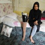 Kahramanmaraş depreminde bacağını kaybeden kadın, kızına hasret yaşıyor