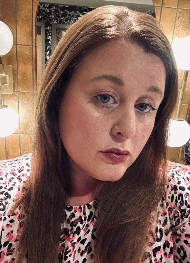 Mitchum deodorantı ciltte yanık bıraktı: Üç kadın Revlon’a dava açtı