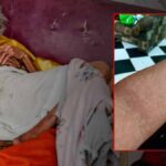 Küba’da Zombi Virüsü Tehditi: Halk Sağlığı Felaketi Derinleşiyor