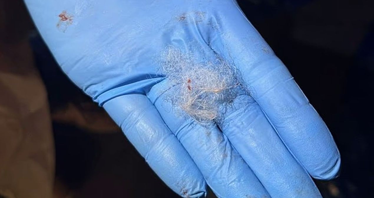 Yün Parçası, İngiltere'den Fransa'ya Giden Et İhraçlarını Durdurdu