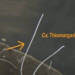 Dünyanın En Büyük Bakterileri Keşfedildi: 5.000 Kat Daha Büyük Tek Hücreli Organizma