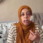 İskenderun'da Kapağı Kırık Rögar Sebebiyle Elektrikli Bisikletten Düşen Kadın Yaralandı