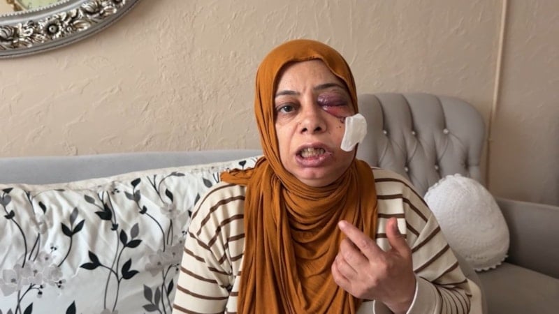 İskenderun'da Kapağı Kırık Rögar Sebebiyle Elektrikli Bisikletten Düşen Kadın Yaralandı