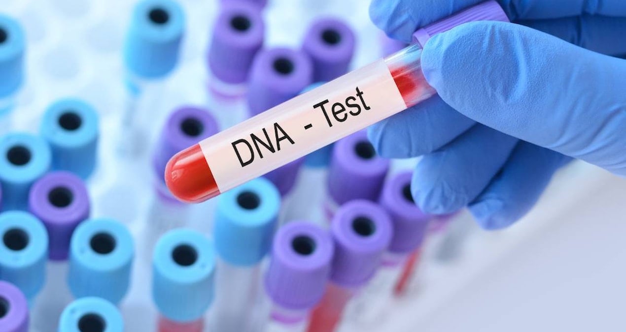 DNA Testiyle Ortaya Çıkan Aile Sırrı Çifti Ayrılmaktan Vazgeçirdi