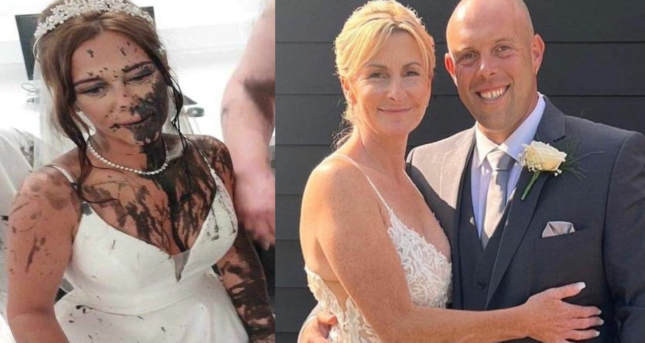 Gelin Düğün Günü Görümcesinin Saldırısına Uğradı, Şok Edici Olay İngiliz Basınında Gündem Oldu