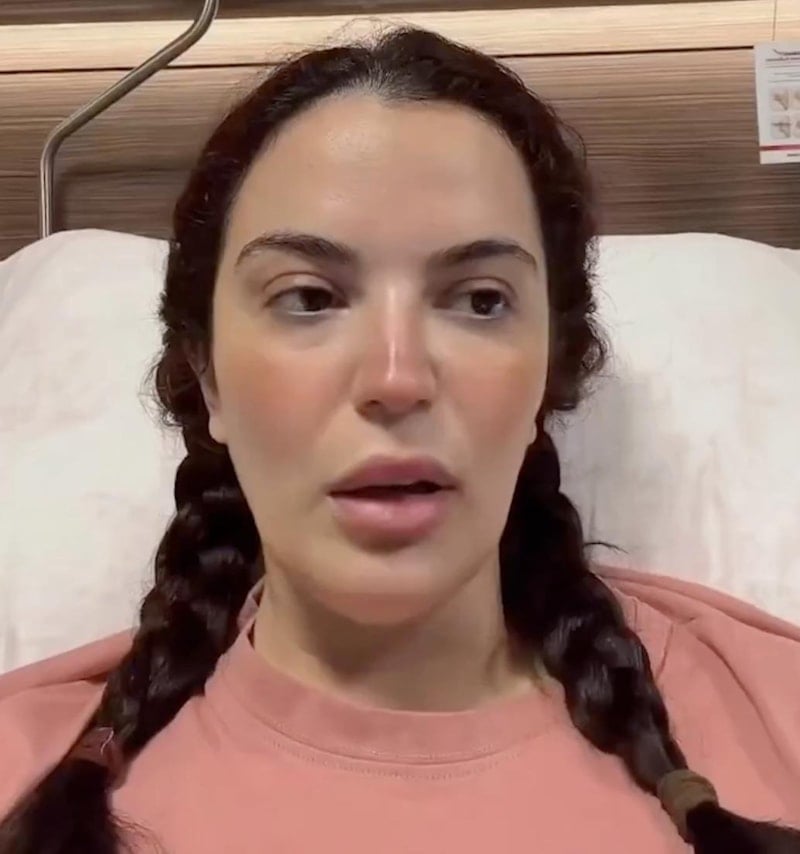 Aslı Bekiroğlu: 7 Ameliyat Geçirdim, Bedenim Deforme Oldu