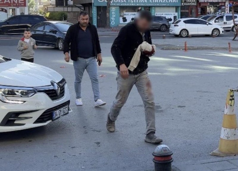 Kurban Bayramı'nda Acemi Kasaplar Hastanelere Akın Etti