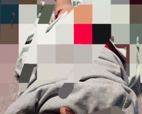 Van'da Sokak Köpekleri Çocuğu Yaraladı, Güvenlik Sorunu Yeniden Gündemde